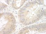 EAF2 Polyclonal Antibody