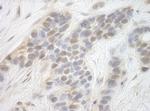CDK8 Polyclonal Antibody