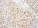 TFIP11 Antibody in Immunohistochemistry (Paraffin) (IHC (P))