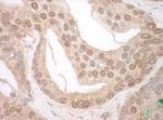 TFIP11 Polyclonal Antibody