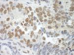 SF3A3 Antibody in Immunohistochemistry (Paraffin) (IHC (P))