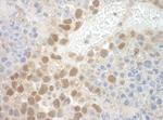 POGZ Antibody in Immunohistochemistry (Paraffin) (IHC (P))