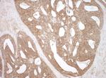 NEDD4L Polyclonal Antibody