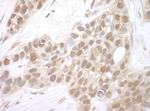 MERIT40 Polyclonal Antibody