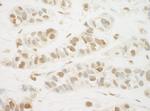 MED13L Polyclonal Antibody