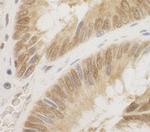 CDC6 Polyclonal Antibody