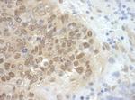 CDC6 Antibody in Immunohistochemistry (Paraffin) (IHC (P))