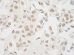 Ku70 Antibody in Immunohistochemistry (Paraffin) (IHC (P))
