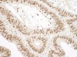Ku70 Antibody in Immunohistochemistry (Paraffin) (IHC (P))