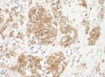 Cortactin Polyclonal Antibody