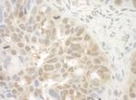 EYA4 Antibody in Immunohistochemistry (Paraffin) (IHC (P))