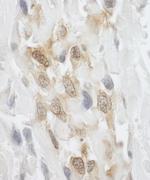 LPP Polyclonal Antibody