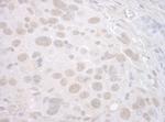 CTNNBL1 Antibody in Immunohistochemistry (Paraffin) (IHC (P))
