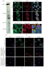 Calreticulin Antibody in Immunocytochemistry (ICC/IF)