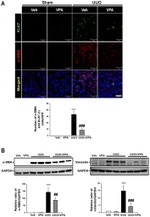 Ki-67 Antibody in Immunohistochemistry (IHC)