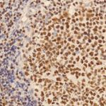 IKAROS Antibody in Immunohistochemistry (IHC)