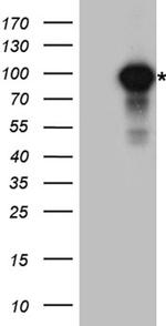 IKBKB Antibody in Western Blot (WB)