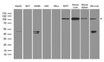IKBKB Antibody in Western Blot (WB)