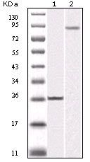 IKK beta Monoclonal Antibody (10A2)
