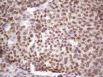 IKBKE Antibody in Immunohistochemistry (Paraffin) (IHC (P))