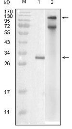 IKK epsilon Monoclonal Antibody (6B4B5)