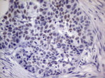 IKZF3 Antibody in Immunohistochemistry (Paraffin) (IHC (P))