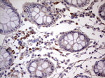 IKZF3 Antibody in Immunohistochemistry (Paraffin) (IHC (P))