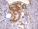 IKZF3 Antibody in Immunohistochemistry (Paraffin) (IHC (P))