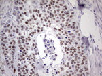 IKZF3 Antibody in Immunohistochemistry (Paraffin) (IHC (P))