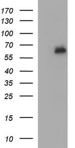 IL10RA Antibody in Western Blot (WB)
