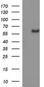 IL10RA Antibody in Western Blot (WB)