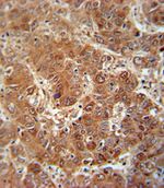 IL-18 Antibody in Immunohistochemistry (IHC)