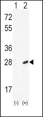 IL-18 Antibody in Western Blot (WB)