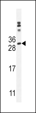 IL-18 Antibody in Western Blot (WB)