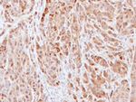 IL-18 Antibody in Immunohistochemistry (Paraffin) (IHC (P))