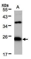 IL-18 Antibody in Western Blot (WB)