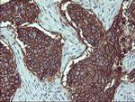 IL1A Antibody in Immunohistochemistry (Paraffin) (IHC (P))