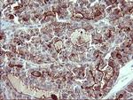 IL1A Antibody in Immunohistochemistry (Paraffin) (IHC (P))