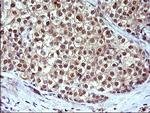 IL1A Antibody in Immunohistochemistry (Paraffin) (IHC (P))
