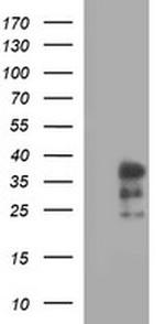 IL1A Antibody in Western Blot (WB)