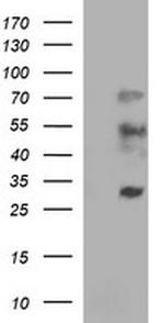 IL1A Antibody in Western Blot (WB)