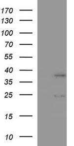 IL1A Antibody in Western Blot (WB)