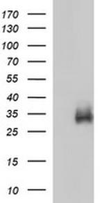 IL1B Antibody in Western Blot (WB)