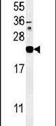 IL1F6 Antibody in Western Blot (WB)