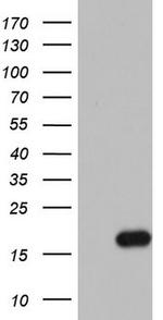 IL1RN Antibody in Western Blot (WB)