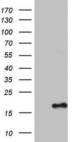 IL1RN Antibody in Western Blot (WB)