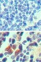 IL23R Antibody in Immunohistochemistry (Paraffin) (IHC (P))