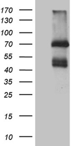 IL2RB Antibody in Western Blot (WB)