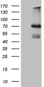 IL2RB Antibody in Western Blot (WB)
