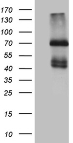 IL2RB Antibody in Western Blot (WB)